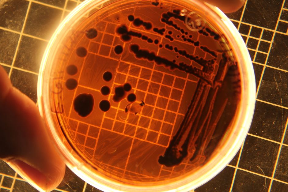 E. coli không có não nhưng vẫn biết ngửi, nhớ và tìm đường đến thức ăn